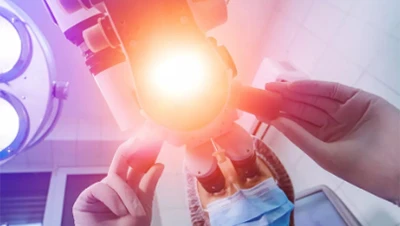 Interpretasi terbaru dari aplikasi medis laser picosecond